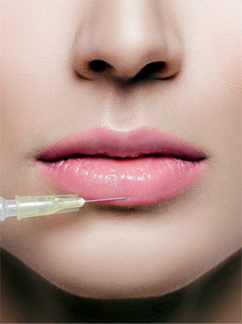 Lips having injection